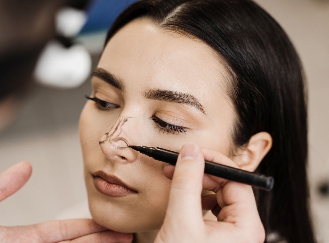 Laser em Rinoplastia: Real Avanço ou Apenas Marketing?