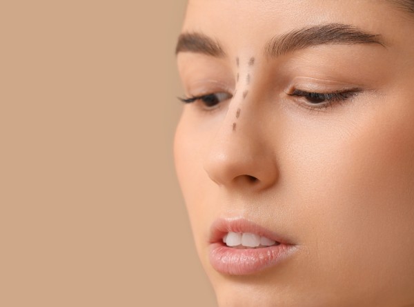 Rinoplastia Estruturada: O Segredo Que Os Cirurgiões Não Querem Que Você Saiba!